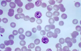 Особенности и применение методов окрашивания клеток